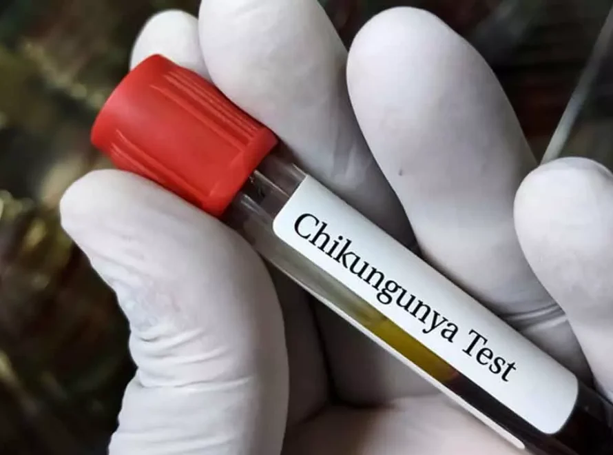 chikungunya test at SRG Hospital Jaipur