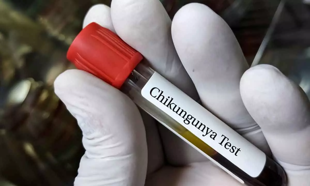 chikungunya test at SRG Hospital Jaipur